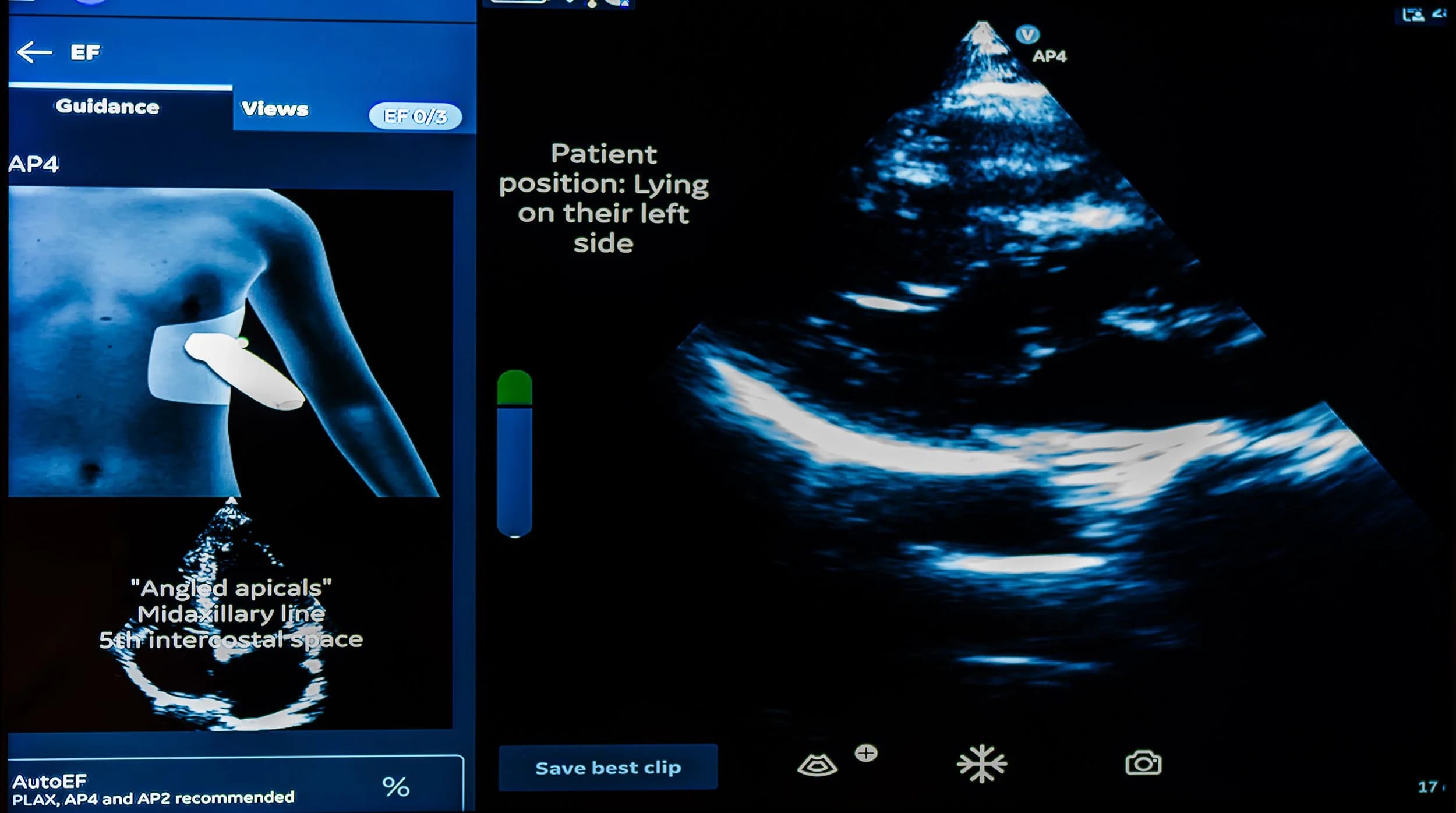 Prior cardiac records and imaging prepared for pre-visit review